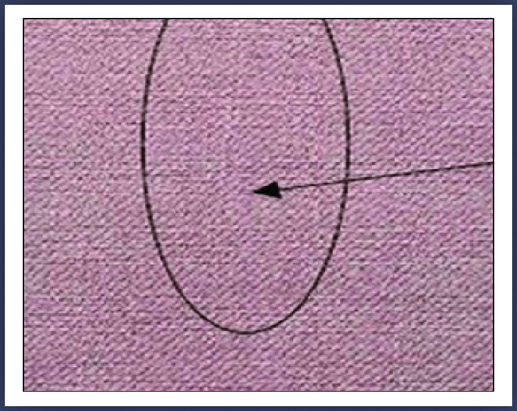 Classify the fault Defects in woven fabric - Apparel Views